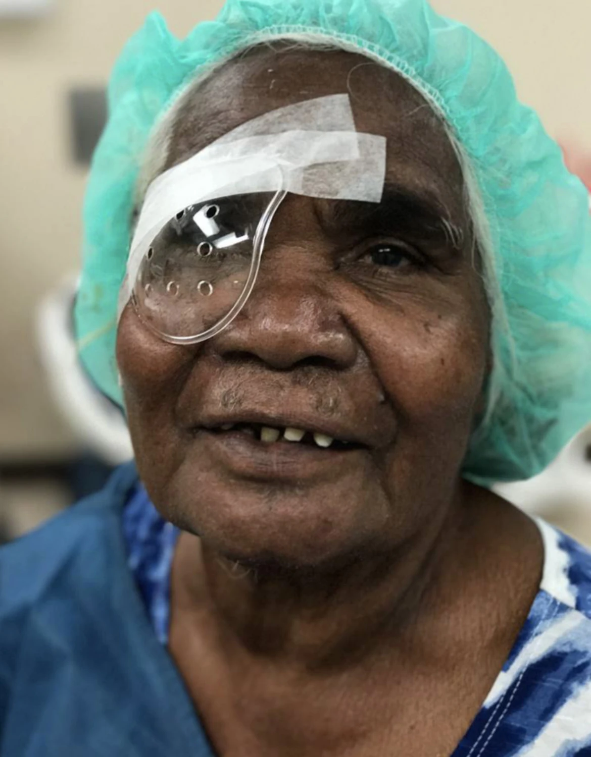 An aboriginal woman post eye operation